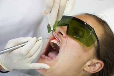 LANAP Laser Gum Treatment in Denver, CO