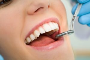 Prevent Gingivitis in Denver, CO