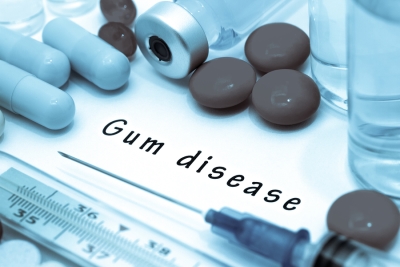 Warning Signs of Gum Disease in Denver
