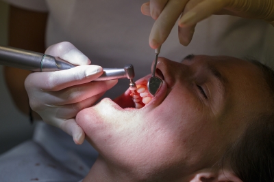 Causes of Gum Diseases in Denver, CO