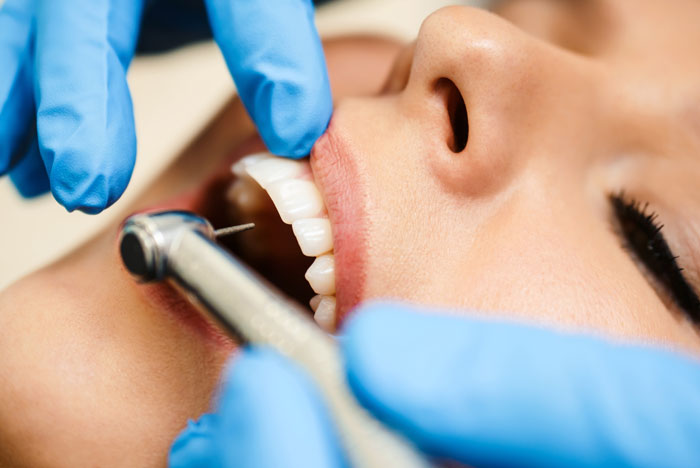 Periodontitis Treatment by Dr Whatcott in Lakewood, CO