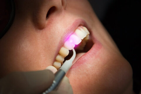 Is Laser Periodontal Treatment Right for Me