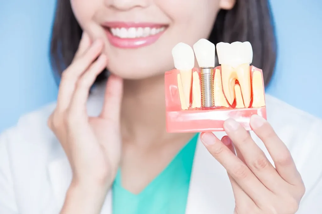 types of dental implants