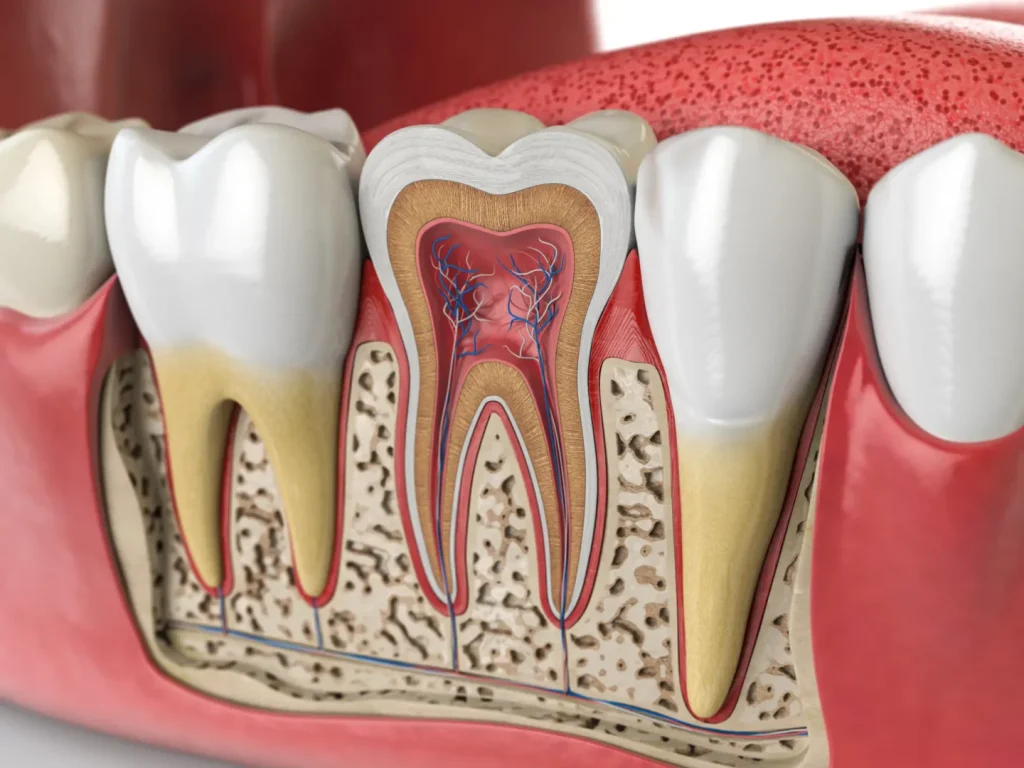 pain after root canal
