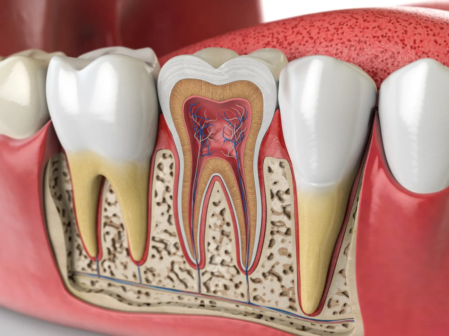pain after root canal