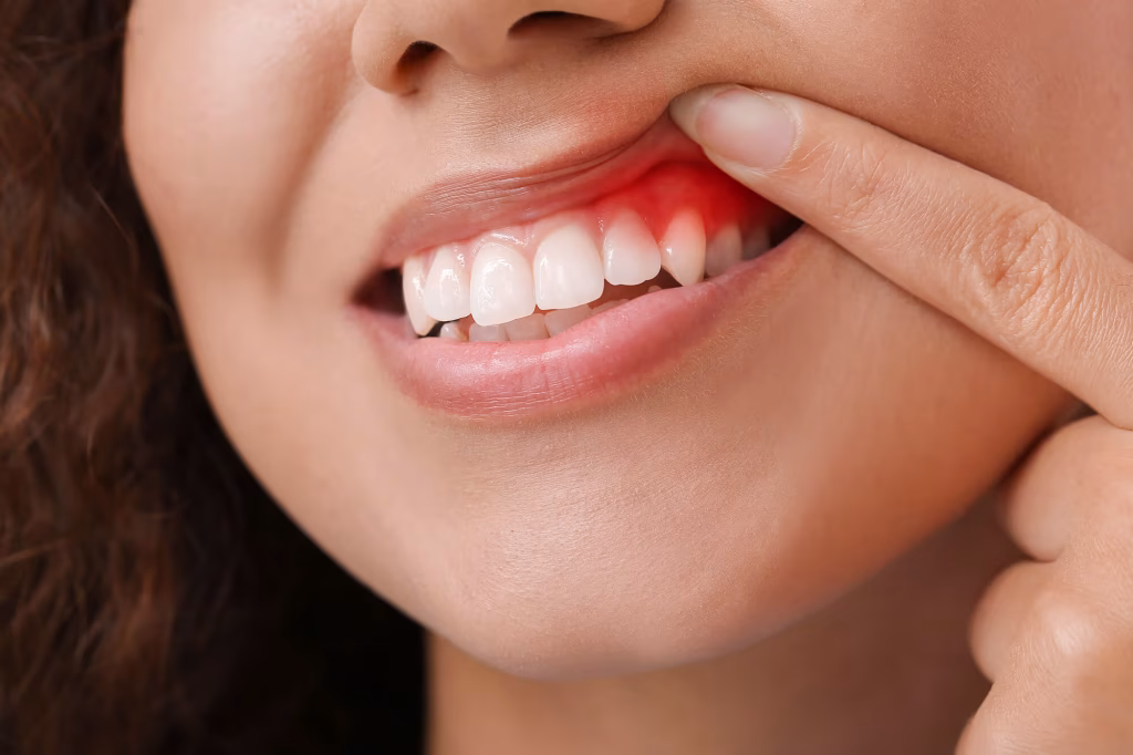 the problems with periodontal disease