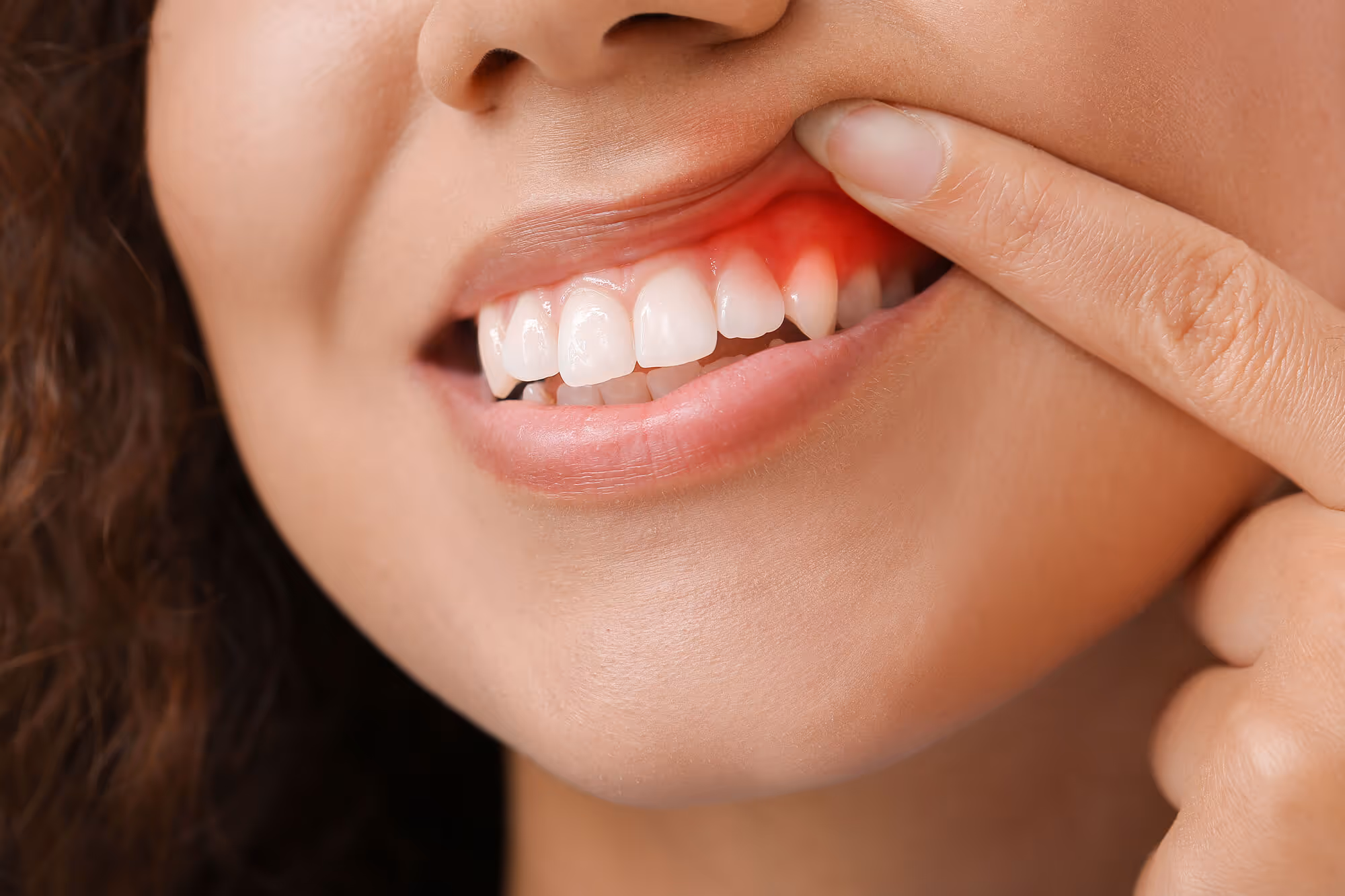 the problems with periodontal disease
