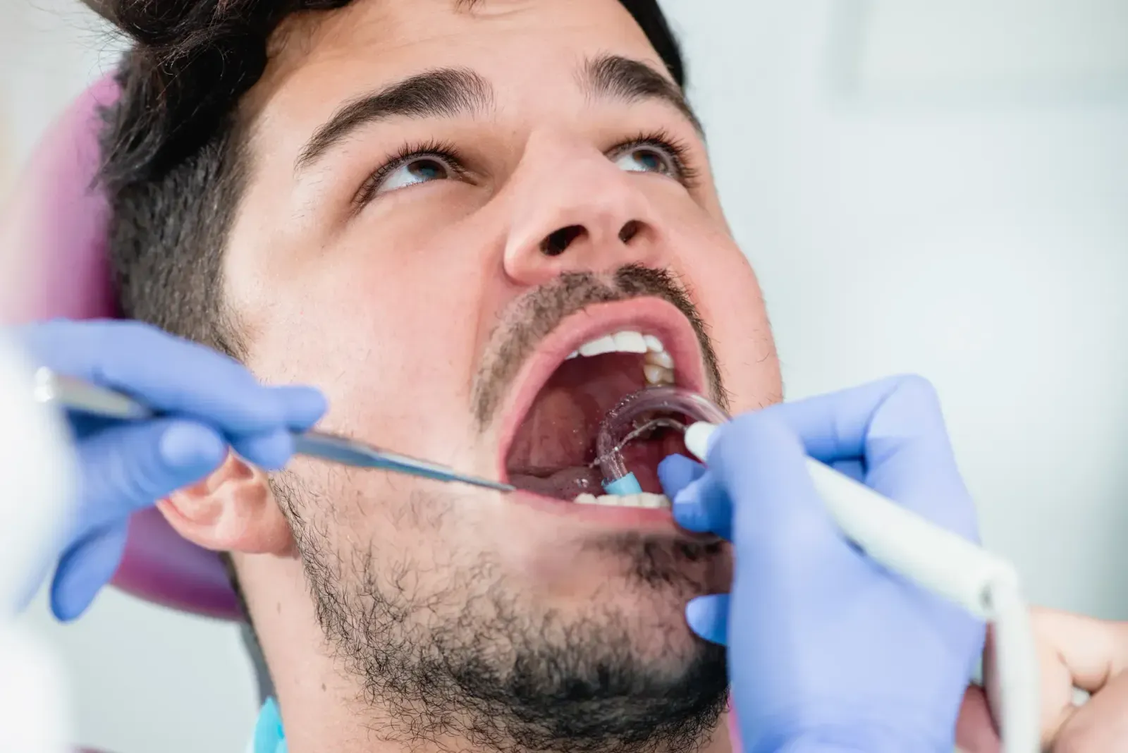 why are dental cleanings painful